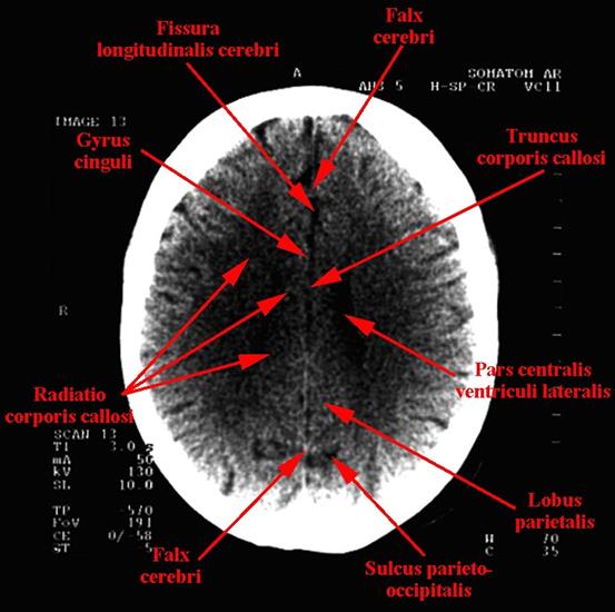 anatomia radiologiczna - 122.jpg